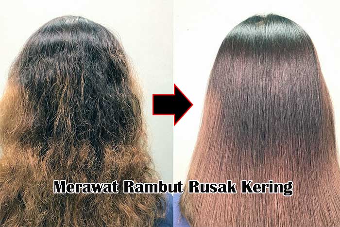 Merawat Rambut Rusak Kering